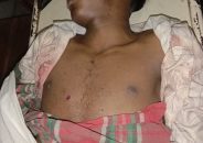 বরিশালে র‌্যাবের ওপর হামলা পাল্টাগুলিতে মাদক ব্যবসায়ী নিহত