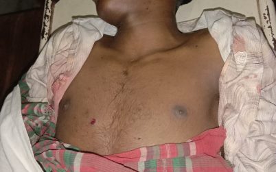 বরিশালে র‌্যাবের ওপর হামলা পাল্টাগুলিতে মাদক ব্যবসায়ী নিহত