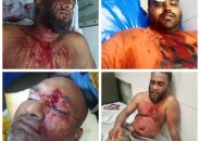 বরিশালে আবারও সন্ত্রাসী আল আমিন বাহিনীর হামলায় আহত ৬