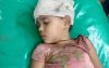 বরিশালে চার বছরের শিশুর সাথে এ কেমন শত্রুতা : ইট দিয়ে থেতলে দেয়া হয়েছে মাথা