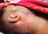 হিজলায় একটি লাশ নিয়ে লুকোচুরি -পুলিশ হতাশ 
