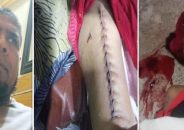 বরিশালে আনসার বাহিনীর গাড়ির ধাক্কায় শিশু নিহত, আহত মা — তিন মাসেও বিচার না পাওয়ার অভিযোগ