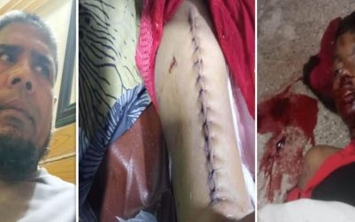 বরিশালে আনসার বাহিনীর গাড়ির ধাক্কায় শিশু নিহত, আহত মা — তিন মাসেও বিচার না পাওয়ার অভিযোগ